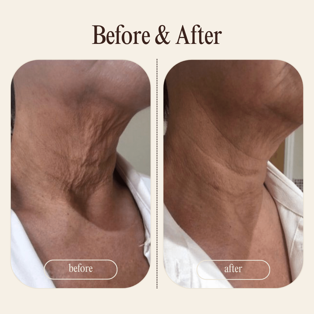 Tighten & Lift Neck Cream