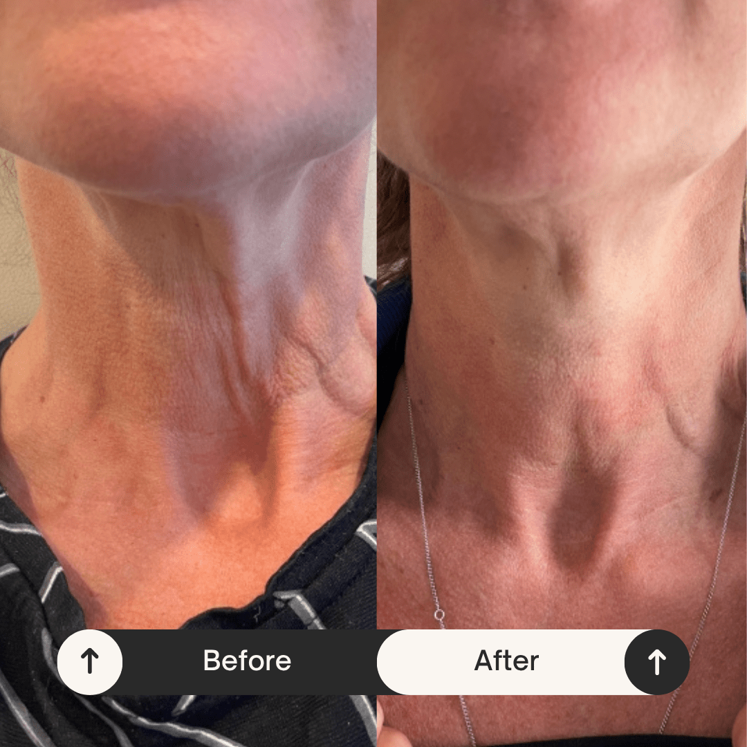 Tighten & Lift Neck Cream