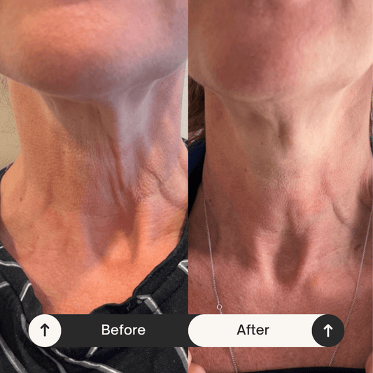 Tighten & Lift Neck Cream